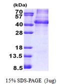 Human NANOGP8 protein, His tag. GTX57518-pro