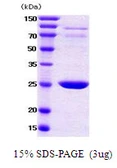 Human 14-3-3 beta protein. GTX57523-pro