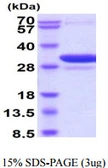 Human 14-3-3 beta protein, His tag. GTX57524-pro