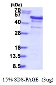 Human YB1 protein, His tag. GTX57525-pro