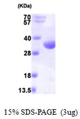 Human RQCD1 protein, His tag. GTX57528-pro