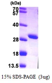 Human Adenylate kinase 4 protein, His tag. GTX57536-pro