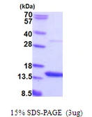 Human AAMDC protein, His tag. GTX57537-pro