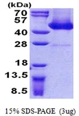 Human FLJ11506 protein, His tag. GTX57538-pro