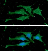 Anti-Calmodulin antibody [J4D8] used in Immunocytochemistry/ Immunofluorescence (ICC/IF). GTX57543