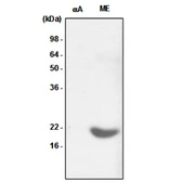 Anti-alpha B Crystallin antibody [2E8] used in Western Blot (WB). GTX57544