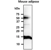 Anti-FABP4 antibody [3F4] used in Western Blot (WB). GTX57547