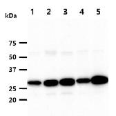 Anti-HMGB1 antibody [J2E1] used in Western Blot (WB). GTX57549