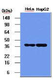Anti-Nucleophosmin antibody [5E3] used in Western Blot (WB). GTX57555