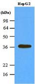 Anti-PPP1A antibody [4G3] used in Western Blot (WB). GTX57557
