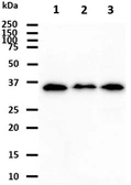 Anti-KCTD15 antibody [AT2B11] used in Western Blot (WB). GTX57561