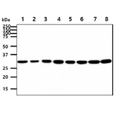 Anti-IL6 antibody [AT1H6] used in Western Blot (WB). GTX57562