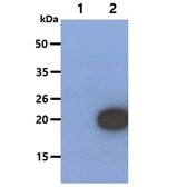 Anti-RBP4 antibody [AT2B4] used in Western Blot (WB). GTX57569