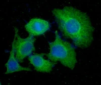 Anti-Thymidylate synthase antibody [AT1S5] used in Immunocytochemistry/ Immunofluorescence (ICC/IF). GTX57572