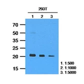 Anti-RAS antibody [AT2G9] used in Western Blot (WB). GTX57577