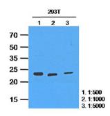 Anti-HPRT antibody [AT2G8] used in Western Blot (WB). GTX57578