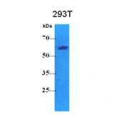 Anti-Pyruvate Kinase (liver/RBC) antibody [AT1E3] used in Western Blot (WB). GTX57581