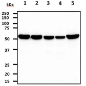 Anti-Pyruvate Kinase (liver/RBC) antibody [AT1E3] used in Western Blot (WB). GTX57581