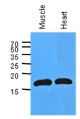 Anti-Myoglobin antibody [AT6E10] used in Western Blot (WB). GTX57584