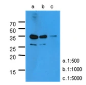 Anti-Amphiregulin antibody [AT1D10] used in Western Blot (WB). GTX57585
