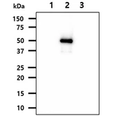 Anti-NSE antibody [AT17D10] used in Western Blot (WB). GTX57594