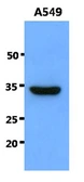 Anti-SNAI1 antibody [AT2D5] used in Western Blot (WB). GTX57596