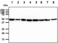 Anti-HIP antibody [AT5C6] used in Western Blot (WB). GTX57598