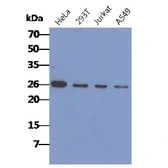 Anti-CacyBP antibody [AT3G8] used in Western Blot (WB). GTX57600