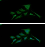 Anti-PKM antibody [AT1B10] used in Immunocytochemistry/ Immunofluorescence (ICC/IF). GTX57604