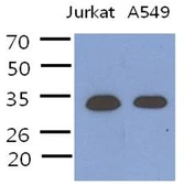 Anti-PDCL3 antibody [AT8F9] used in Western Blot (WB). GTX57608