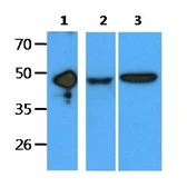 Anti-EDAR antibody [AT19E8] used in Western Blot (WB). GTX57609