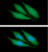 Anti-Cytokeratin 14 antibody [AT13F4] used in Immunocytochemistry/ Immunofluorescence (ICC/IF). GTX57611