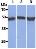 Anti-Cytokeratin 17 antibody [AT9F3] used in Western Blot (WB). GTX57612
