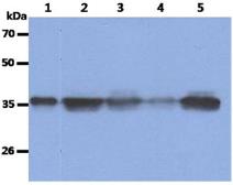 Anti-Nucleophosmin antibody [AT23F1] used in Western Blot (WB). GTX57613