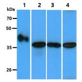 Anti-GOT2 antibody [AT8B11] used in Western Blot (WB). GTX57618
