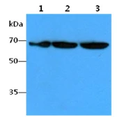Anti-FUBP1 antibody [AT14F5] used in Western Blot (WB). GTX57628