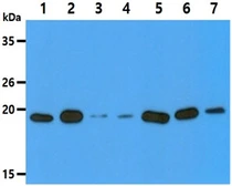 Anti-DUSP3 antibody [AT9E6] used in Western Blot (WB). GTX57630