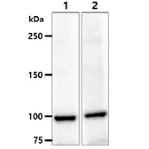 Anti-alpha Actinin 1 antibody [AT1D10] used in Western Blot (WB). GTX57633