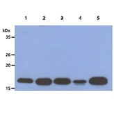 Anti-ACP1 antibody [AT5C11] used in Western Blot (WB). GTX57643