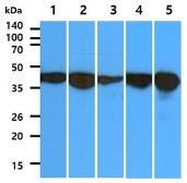Anti-Aldolase C antibody [AT2E11] used in Western Blot (WB). GTX57650