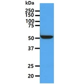 Anti-ALDH5A1 antibody [AT17F5] used in Western Blot (WB). GTX57651