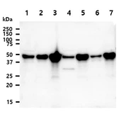 Anti-NDRG1 antibody [AT11G4] used in Western Blot (WB). GTX57654