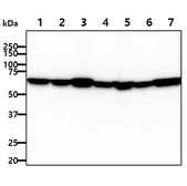 Anti-AIF antibody [AT22E9] used in Western Blot (WB). GTX57664