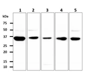 Anti-GPD1L antibody [AT14E2] used in Western Blot (WB). GTX57667