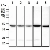 Anti-PGD antibody [AT46B3] used in Western Blot (WB). GTX57669