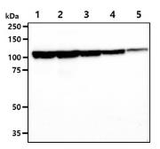 Anti-JAK2 antibody [AT53B7] used in Western Blot (WB). GTX57670