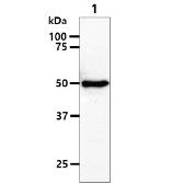 Anti-RUVBL1 antibody [AT1D6] used in Western Blot (WB). GTX57672