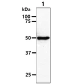 Anti-RUVBL1 antibody [AT1D6] used in Western Blot (WB). GTX57672