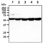 Anti-UGDH antibody [AT2G11] used in Western Blot (WB). GTX57674