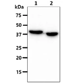 Anti-ACAA1 antibody [AT9E5] used in Western Blot (WB). GTX57678